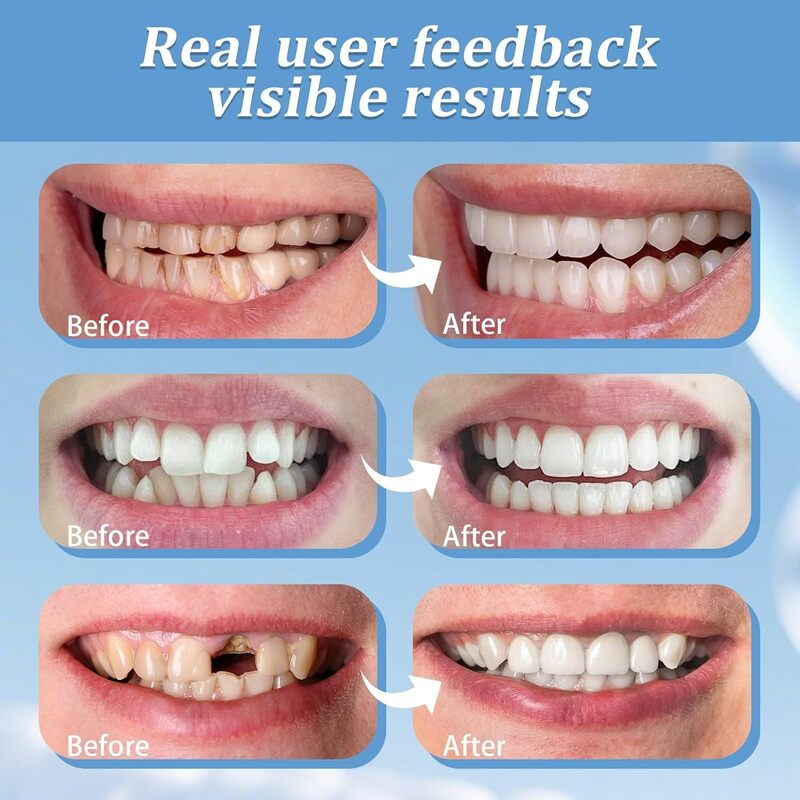 Silicone Teeth Cover