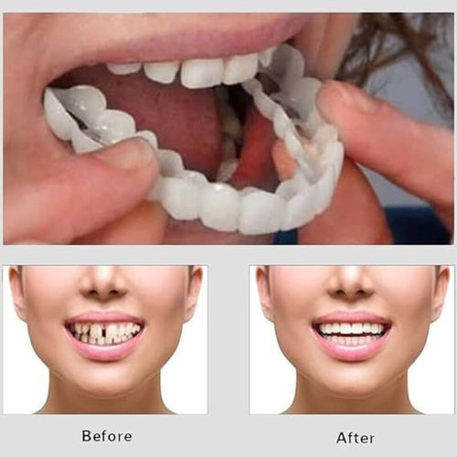 Silicone Teeth Cover